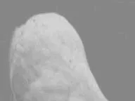 Foot p