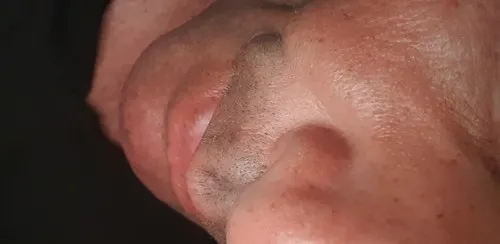 Man72