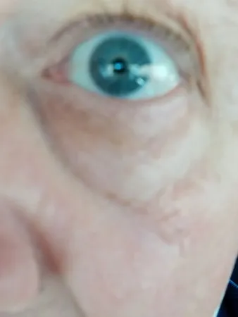 פיקוח