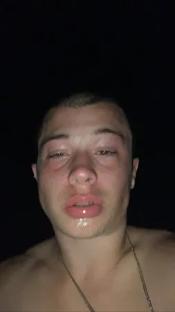 צימוק
