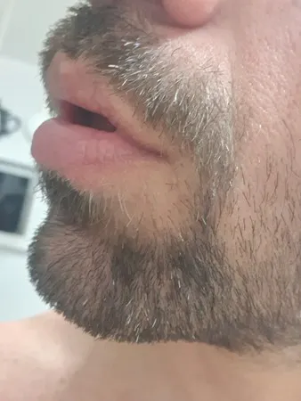 דרוג 9.9 🤗