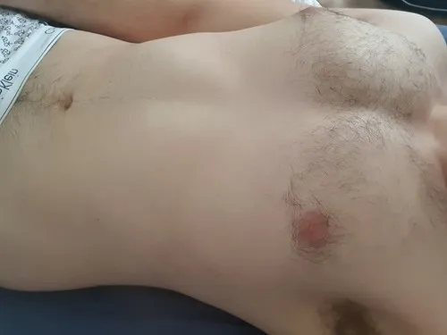 Hornuy