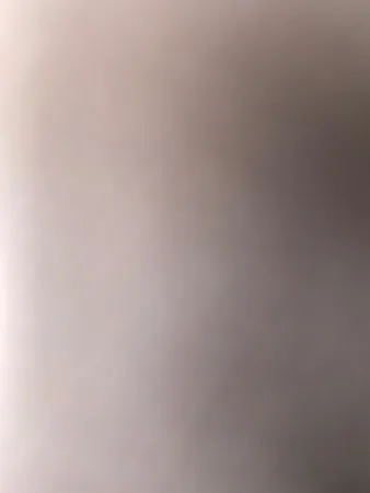 המלרמן