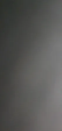 חזקוס