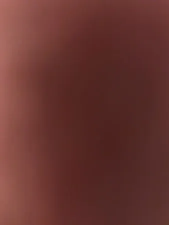 Grossebite