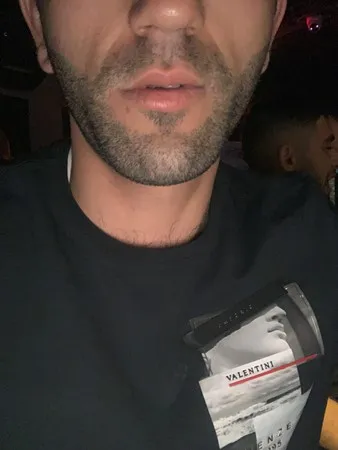 יוניinon