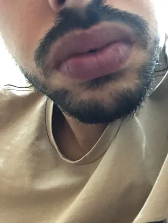 Moon69 