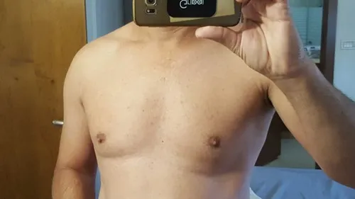 federico1