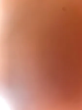פללפ