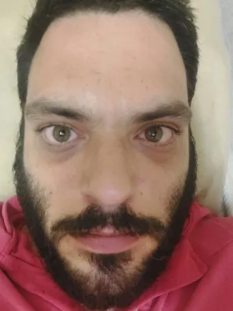 Xzedoz