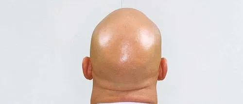 פראדי32