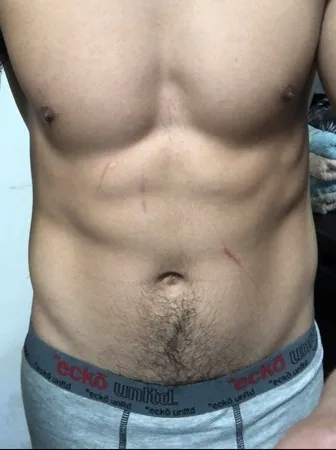 Mor115
