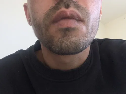 חולהלאפה שאורמה