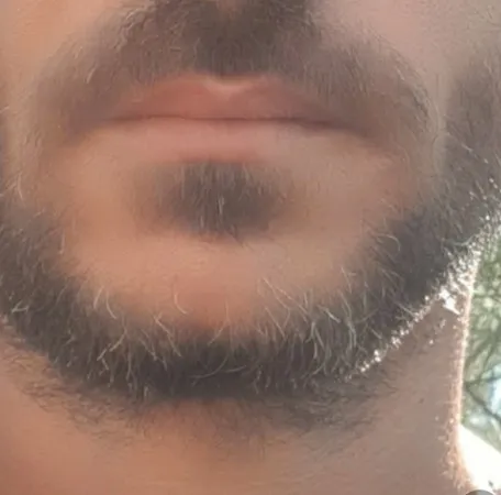 החסר