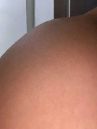 Hot6969 