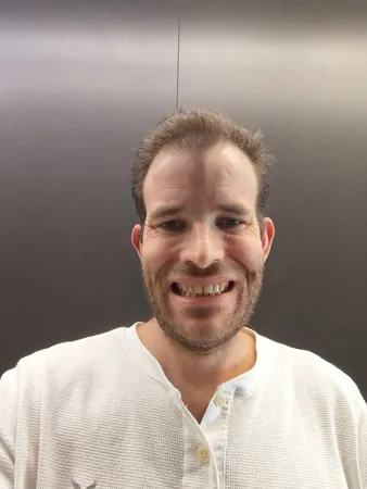 גבש