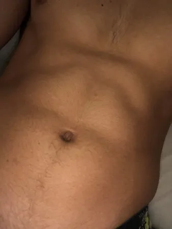 Aaaa22726