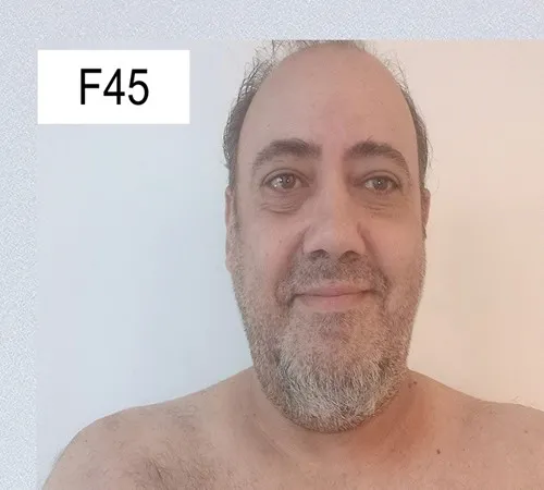 פוקצה