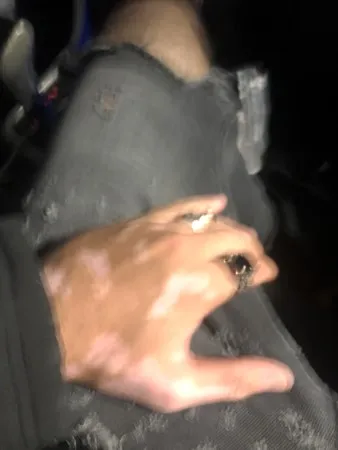 Xanax