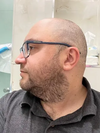 קארלסון