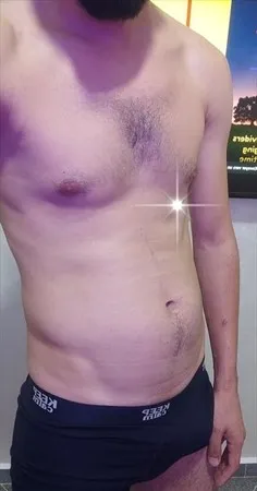 אמיר 🥰👙🔥מ