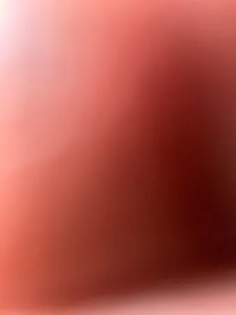 איצי /5