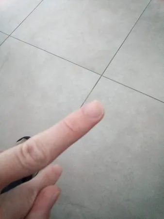 Eli חולה ציצי