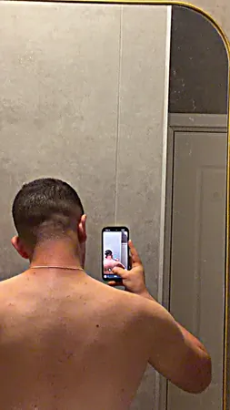 ברק אבוקסיס